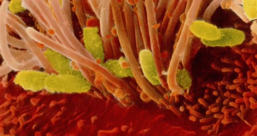 Trápí Vás černý kašel?